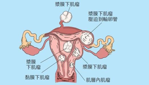 哪些情況可以放心赴美生子？海外生子的難度有哪些？