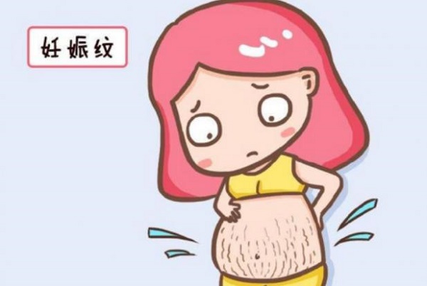 美國月子中心教您可以減淡妊娠紋的小妙招