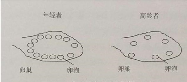 美國第三代試管技術(shù)