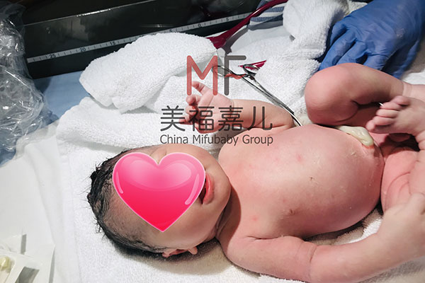 美國生孩子痛嗎